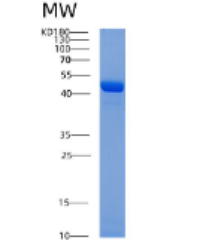 Recombinant Human ADRM1 Protein,Recombinant Human ADRM1 Protein