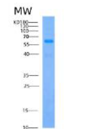 Recombinant Human ACSF2 Protein,Recombinant Human ACSF2 Protein