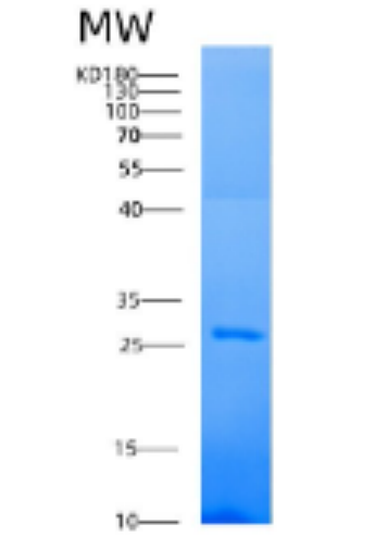 Recombinant Human AK4 Protein,Recombinant Human AK4 Protein