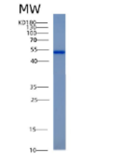 Recombinant Human ACY1 Protein,Recombinant Human ACY1 Protein