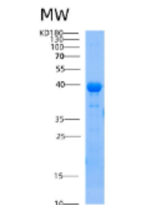 Recombinant Human AIP Protein,Recombinant Human AIP Protein