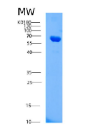 Recombinant Human AIFM1 Protein,Recombinant Human AIFM1 Protein