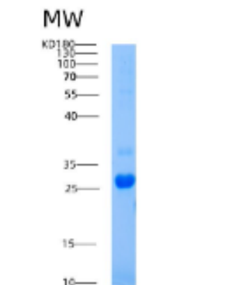 Recombinant Human AICDA Protein,Recombinant Human AICDA Protein