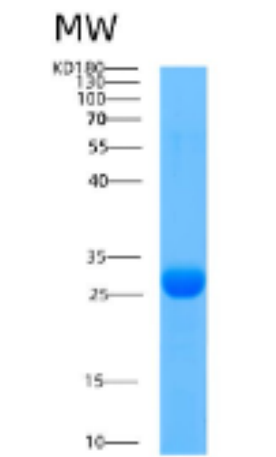 Recombinant Human Adenylate kinase 3(C22S) Protein,Recombinant Human Adenylate kinase 3(C22S) Protein