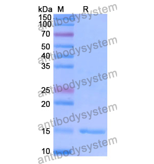 抗 Human TUFM 纳米抗体 (SAA1227)(RHE65201),Anti-Human TUFM Nanobody (SAA1227)