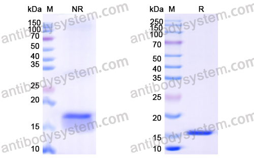 抗 Human EGFR/ERBB1/HER1 纳米抗体 (SAA1038)(RHB86903),Anti-Human EGFR/ERBB1/HER1 Nanobody (SAA1038)
