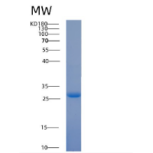 Recombinant Human 14-3-3 τ/ YWHAQ Protein,Recombinant Human 14-3-3 τ/ YWHAQ Protein