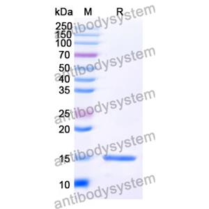 抗 SARS-CoV-2 S Protein 纳米抗体 (SAA1066)(RVV00155),Anti-SARS-CoV-2 S Protein Nanobody (SAA1066)