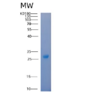 Recombinant Human 14-3-3 β/YWHAB Protein