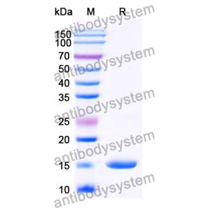 Anti-Human VWF Nanobody (SAA0972)