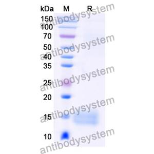 抗 Human LRP6 纳米抗体 (SAA0903)(RHB25302),Anti-Human LRP6 Nanobody (SAA0903)