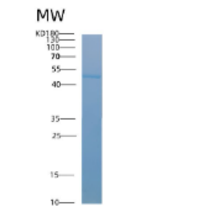 Recombinant Human ACADSB Protein