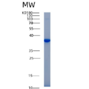 Recombinant Mouse Akr1b1 Protein