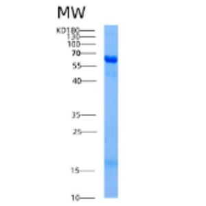 Recombinant Human AK5 Protein