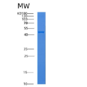 Recombinant Human ADPRH Protein,Recombinant Human ADPRH Protein