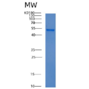 Recombinant Mouse Acy1 Protein,Recombinant Mouse Acy1 Protein