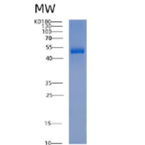 Recombinant Human ACTR3 Protein