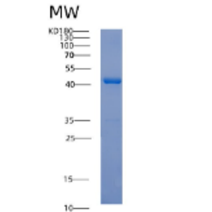 Recombinant Human ACTA2 Protein,Recombinant Human ACTA2 Protein