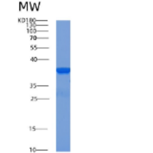 Recombinant Human ACOT8 Protein