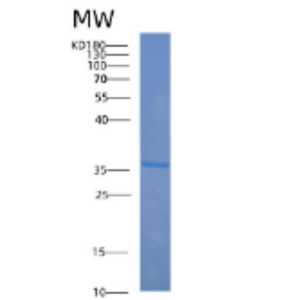 Recombinant Human ABO Protein