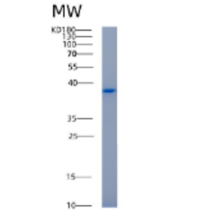 Recombinant Human AKR1C1 Protein