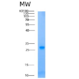 Recombinant Human AK2 Protein