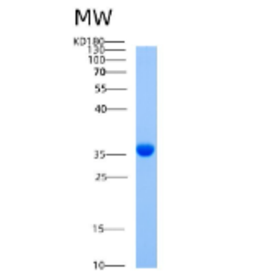 Recombinant Human AIMP1 (Aminoacyl tRNA synthetase complex-interacting multifunctional protein 1) Protein