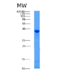 Recombinant Human AFAP1 Protein,Recombinant Human AFAP1 Protein