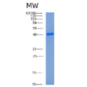 Recombinant Human ADPRHL2 Protein,Recombinant Human ADPRHL2 Protein