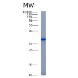 Recombinant Human AKR1B10 Protein