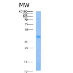 Recombinant Human AIDA Protein