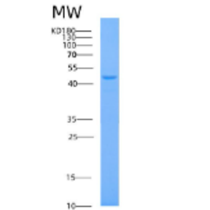 Recombinant Human AHCY Protein