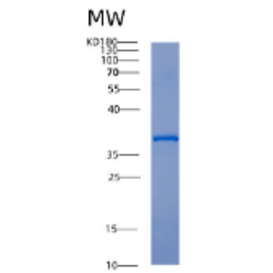 Recombinant Human Activator of Hsp90 ATPase-1 /AHA1 Protein