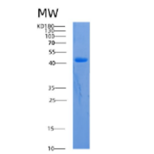 Recombinant Human ACADM Protein