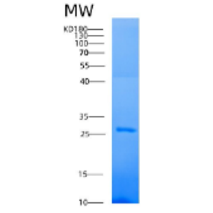 Recombinant Human AK4 Protein