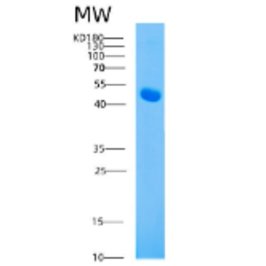 Recombinant Mouse ahsg Protein