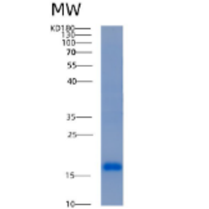 Recombinant Human ACOT13 Protein