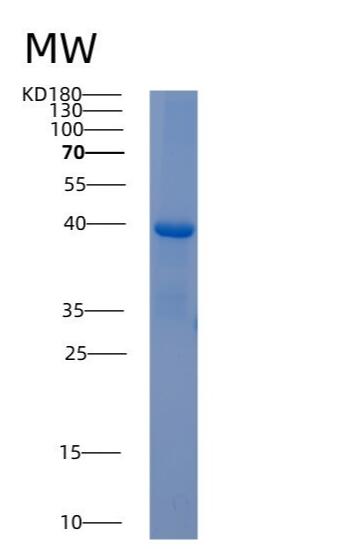 Recombinant Human AKR1C4 Protein,Recombinant Human AKR1C4 Protein