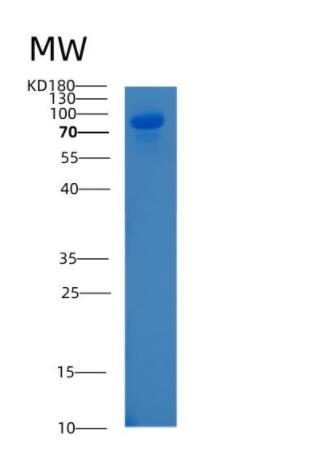 Recombinant Human ALCAM Protein,Recombinant Human ALCAM Protein