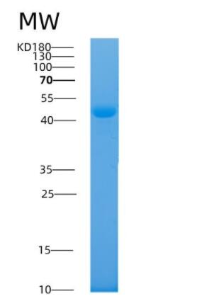 Recombinant Human AKR7A2 Protein,Recombinant Human AKR7A2 Protein