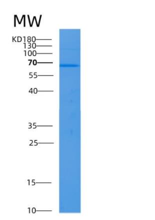 Recombinant Human ALB Protein,Recombinant Human ALB Protein