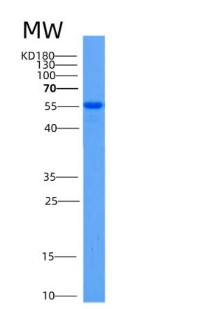 Recombinant Mouse Aldh2 Protein,Recombinant Mouse Aldh2 Protein