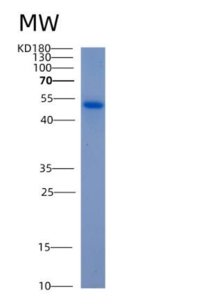 Recombinant Human ALDH5A1 Protein,Recombinant Human ALDH5A1 Protein