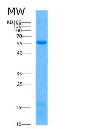 Recombinant Human AKT1 Protein,Recombinant Human AKT1 Protein