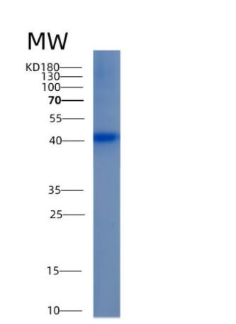 Recombinant Human ALDOB Protein,Recombinant Human ALDOB Protein