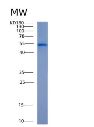 Recombinant Human ALDH2 Protein,Recombinant Human ALDH2 Protein