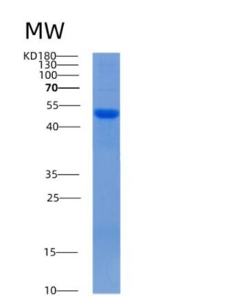 Recombinant Mouse Alpha-2-antiplasmin Protein,Recombinant Mouse Alpha-2-antiplasmin Protein