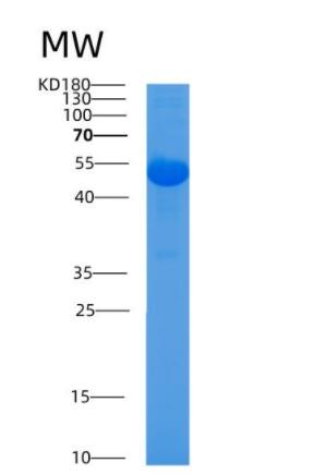 Recombinant Mouse Alpl Protein,Recombinant Mouse Alpl Protein