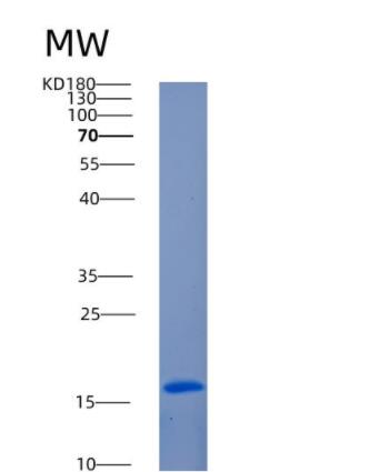 Recombinant Human ANG Protein,Recombinant Human ANG Protein