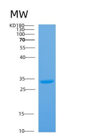 Recombinant Mycobacterium tuberculosisAntigen 85A Protein,Recombinant Mycobacterium tuberculosisAntigen 85A Protein